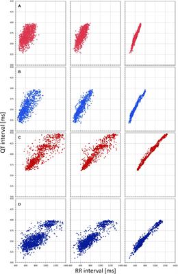 Individually Rate Corrected QTc Intervals in Children and Adolescents